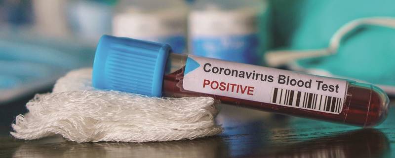 Uptick in active Covid-19 cases; vaccinations available in Devine daily